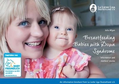 Breastfeeding Babies with Down Syndrome